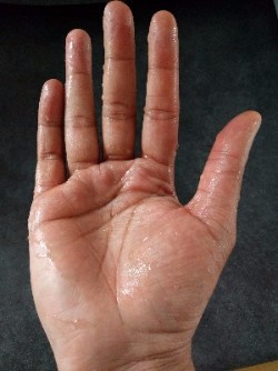 Sweaty Hands